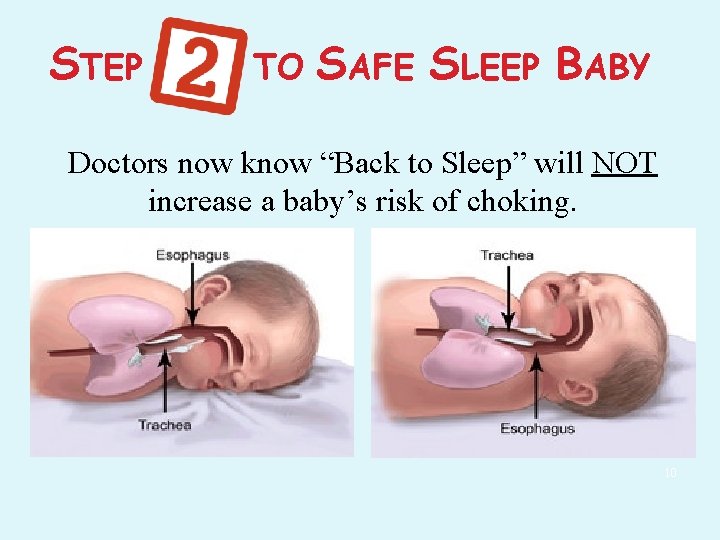 STEP TO SAFE SLEEP BABY Doctors now know “Back to Sleep” will NOT increase