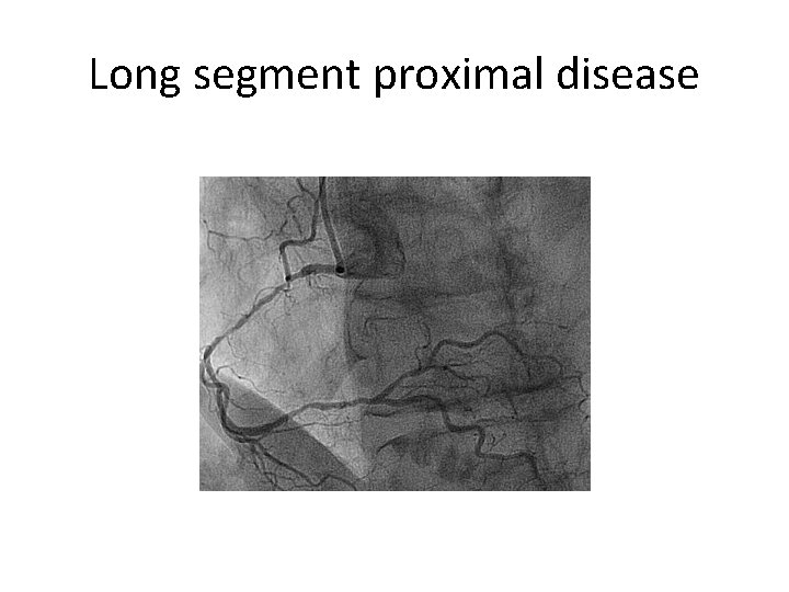 Long segment proximal disease 