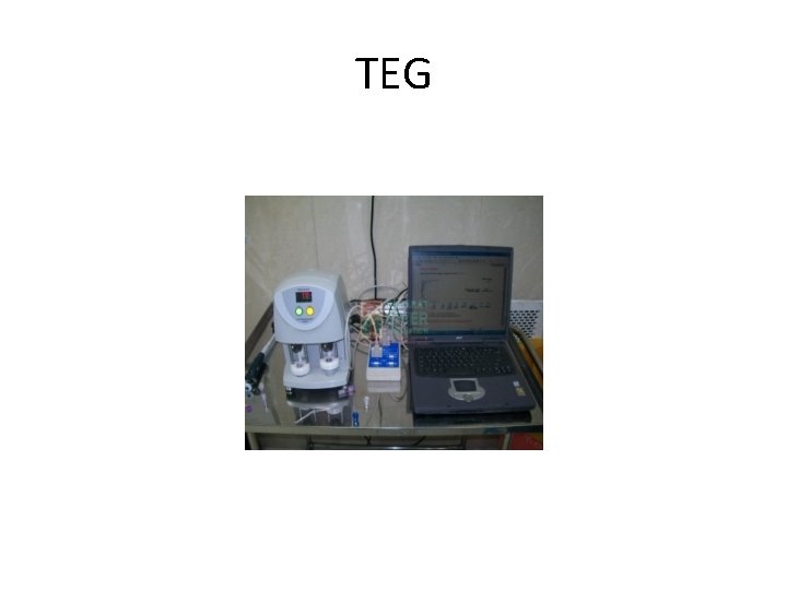 TEG 