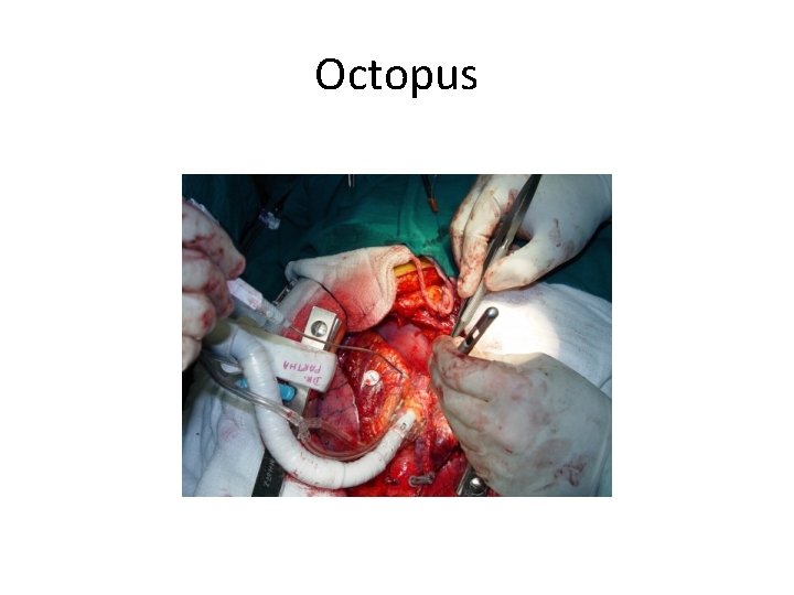Octopus 