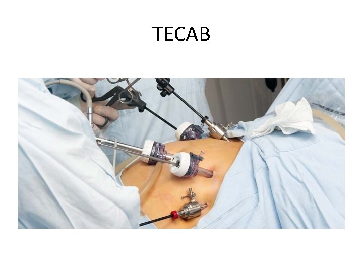 TECAB 