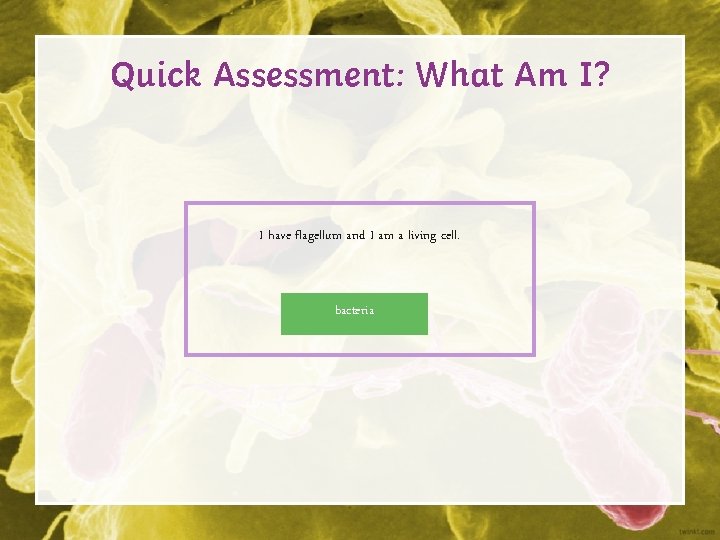 Quick Assessment: What Am I? I have flagellum and I am a living cell.