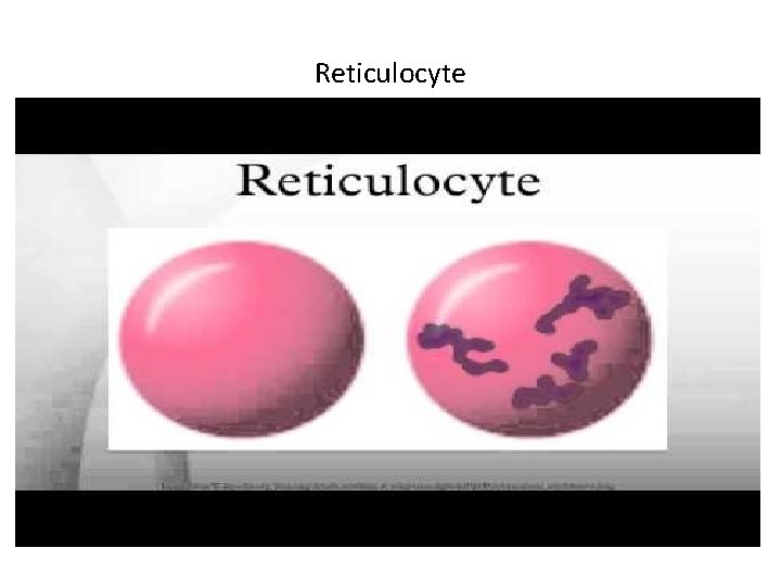 Reticulocyte 