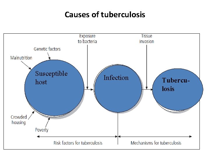 Causes of tuberculosis Susceptible host Infection Tuberculosis 