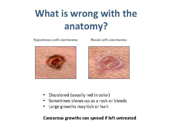 What is wrong with the anatomy? • Discolored (usually red in color) • Sometimes