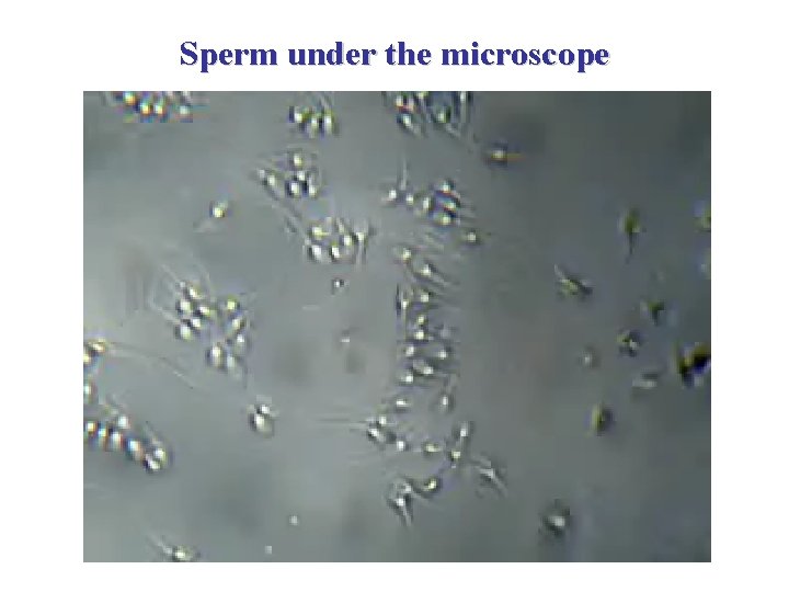 Sperm under the microscope 