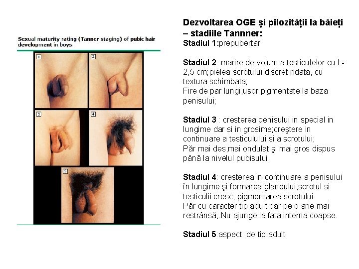 Dezvoltarea OGE și pilozității la băieți – stadiile Tannner: Stadiul 1: prepubertar Stadiul 2