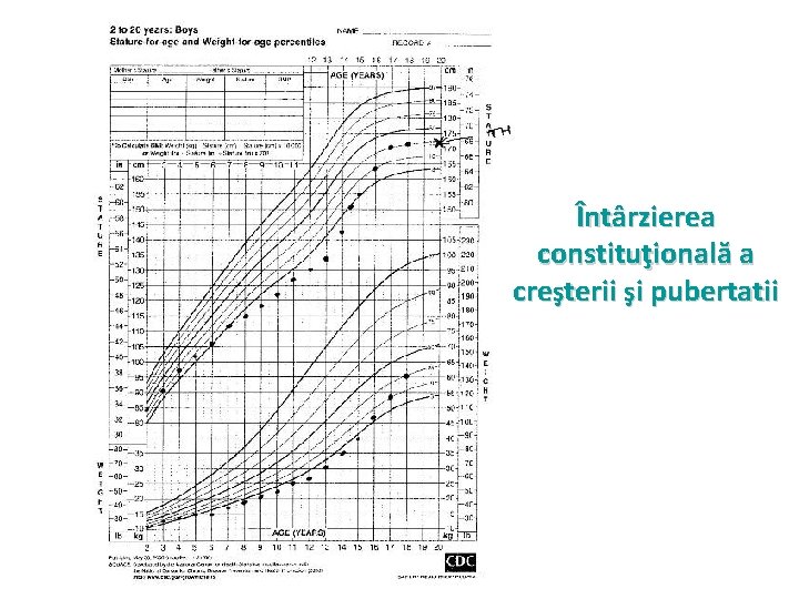 Întârzierea constituţională a creşterii şi pubertatii 