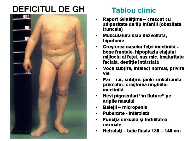 DEFICITUL DE GH Tablou clinic • • • Raport G/înălţime – crescut cu adipozitate