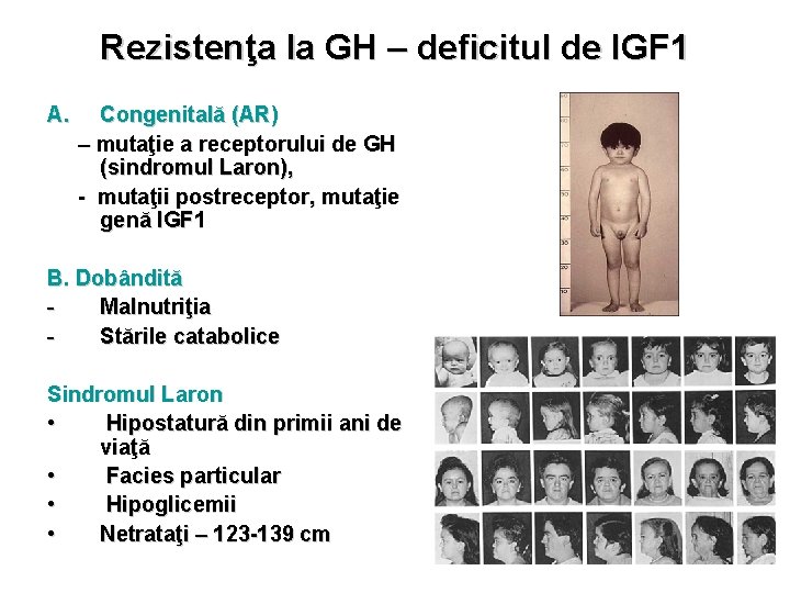 Rezistenţa la GH – deficitul de IGF 1 A. Congenitală (AR) – mutaţie a