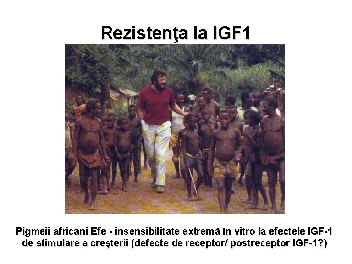 Rezistenţa la IGF 1 Pigmeii africani Efe - insensibilitate extremă în vitro la efectele