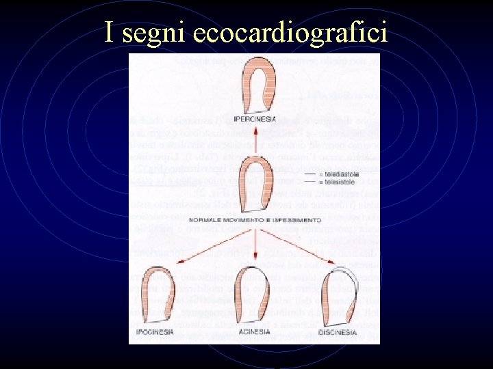 I segni ecocardiografici 