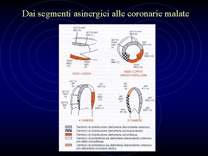 Dai segmenti asinergici alle coronarie malate 