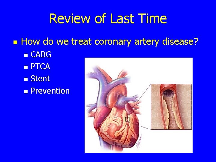 Review of Last Time n How do we treat coronary artery disease? n n