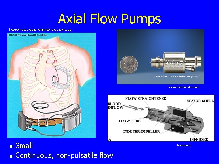 Axial Flow Pumps http: //www. texasheartinstitute. org/J 2 Syss. jpg www. micromedcv. com n