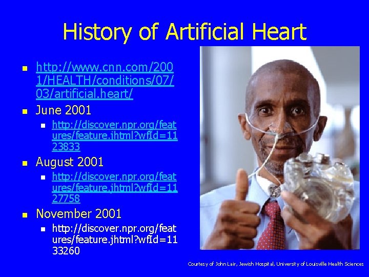 History of Artificial Heart n n http: //www. cnn. com/200 1/HEALTH/conditions/07/ 03/artificial. heart/ June
