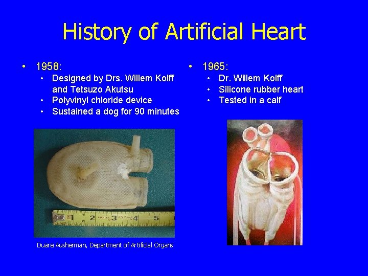 History of Artificial Heart • 1958: • Designed by Drs. Willem Kolff and Tetsuzo