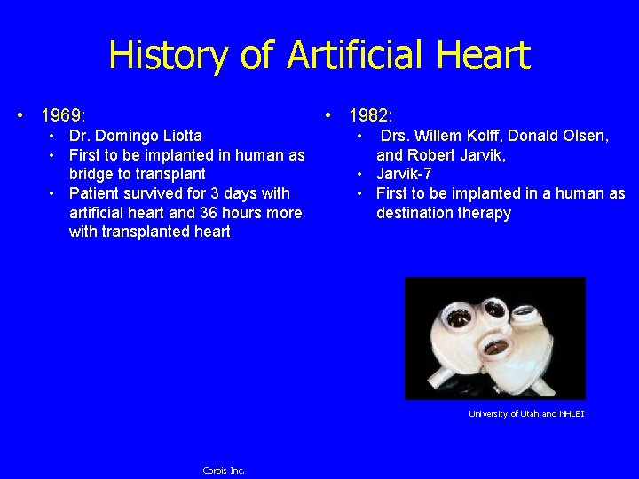History of Artificial Heart • 1969: • 1982: • Dr. Domingo Liotta • First