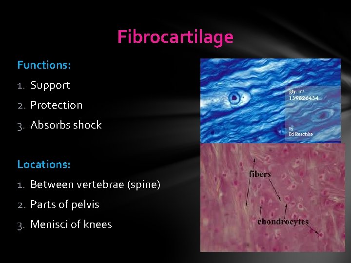 Fibrocartilage Functions: 1. Support 2. Protection 3. Absorbs shock Locations: 1. Between vertebrae (spine) Fibrocartilage Functions: 1. Support 2. Protection 3. Absorbs shock Locations: 1. Between vertebrae (spine)