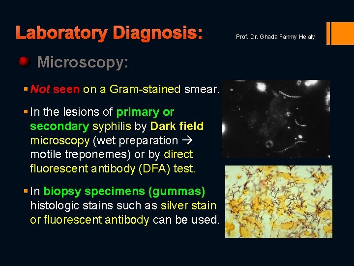 Laboratory Diagnosis: Microscopy: § Not seen on a Gram-stained smear. § In the lesions