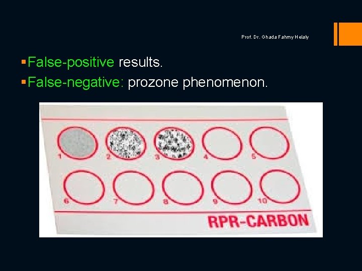 Prof. Dr. Ghada Fahmy Helaly § False-positive results. § False-negative: prozone phenomenon. 