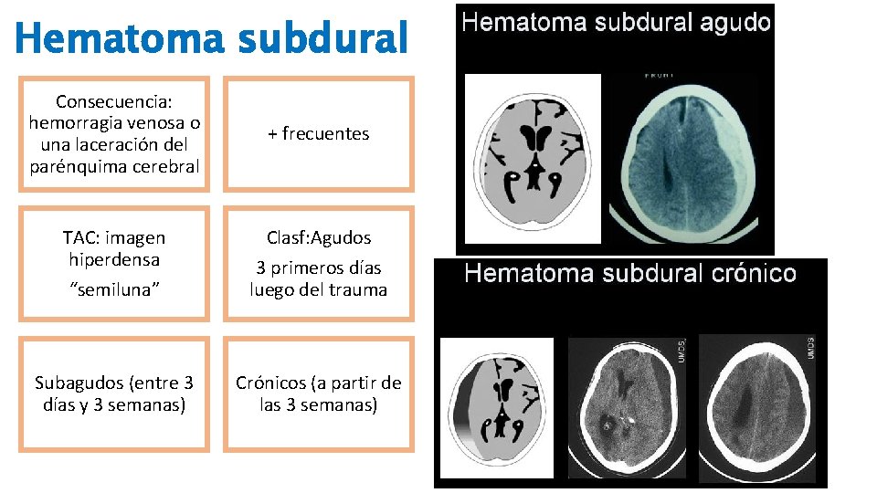 Hematoma subdural Consecuencia: hemorragia venosa o una laceración del parénquima cerebral + frecuentes TAC: