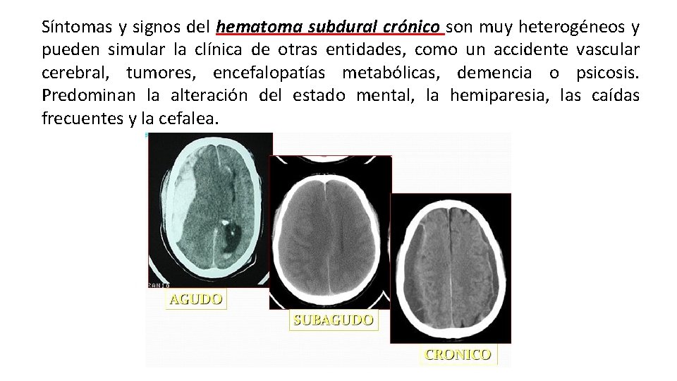 Síntomas y signos del hematoma subdural crónico son muy heterogéneos y pueden simular la