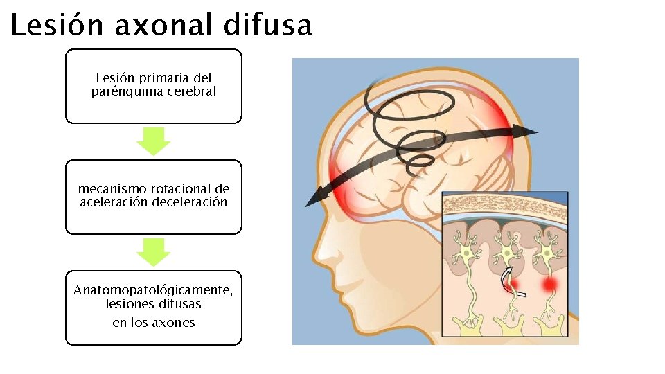 Lesión axonal difusa Lesión primaria del parénquima cerebral mecanismo rotacional de aceleración deceleración Anatomopatológicamente,