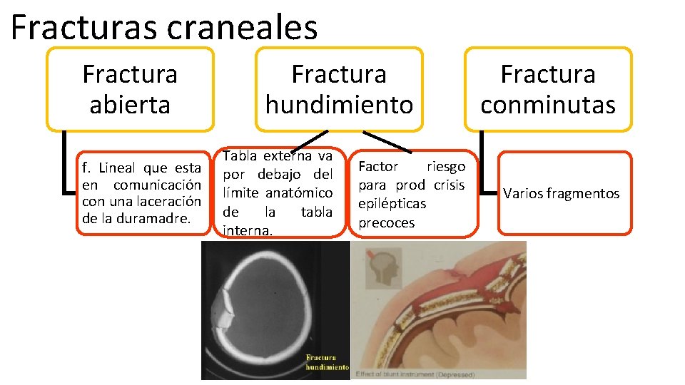 Fracturas craneales Fractura abierta f. Lineal que esta en comunicación con una laceración de