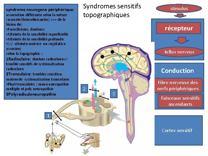 syndrome neurogene périphérique: association différente selon la nature (axonale/demyelinisantes) +++ de la lésion de: