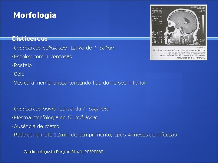 Morfologia Cisticerco: -Cysticercus cellulosae: Larva de T. solium -Escólex com 4 ventosas -Rostelo -Colo