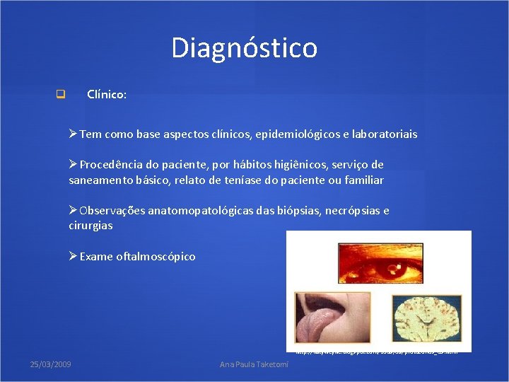 Diagnóstico Clínico: q ØTem como base aspectos clínicos, epidemiológicos e laboratoriais ØProcedência do paciente,