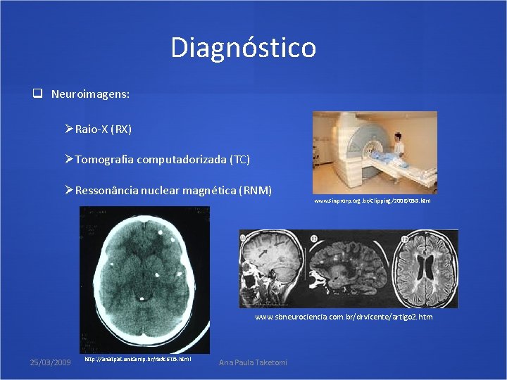 Diagnóstico q Neuroimagens: ØRaio-X (RX) ØTomografia computadorizada (TC) ØRessonância nuclear magnética (RNM) www. sinprorp.