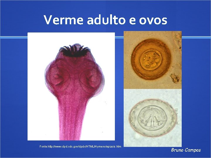 Verme adulto e ovos Fonte: http: //www. dpd. cdc. gov/dpdx/HTML/Hymenolepiasis. htm Bruno Campos 