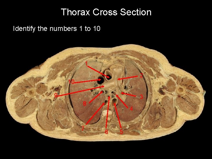 Thorax Cross Section Identify the numbers 1 to 10 1 2 10 9 3