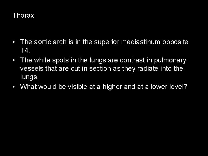Thorax • The aortic arch is in the superior mediastinum opposite T 4. •