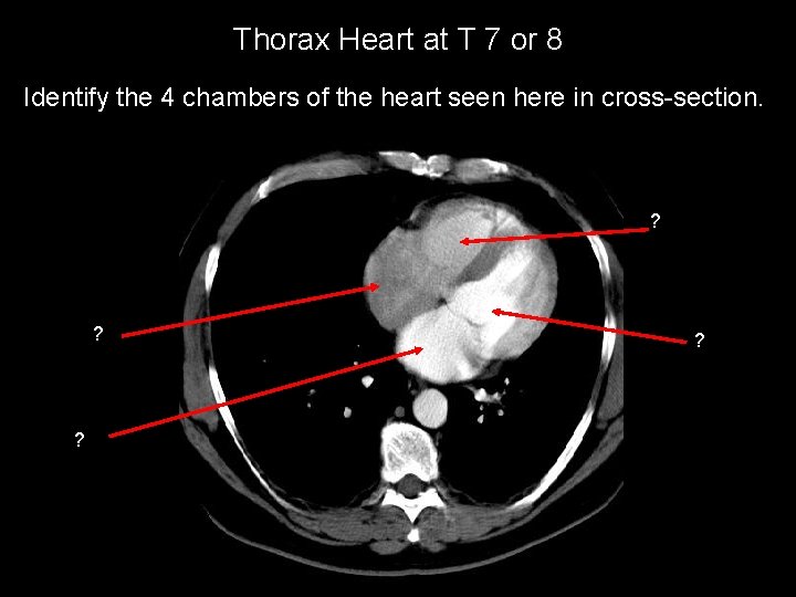 Thorax Heart at T 7 or 8 Identify the 4 chambers of the heart
