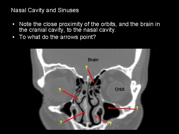 Nasal Cavity and Sinuses • Note the close proximity of the orbits, and the