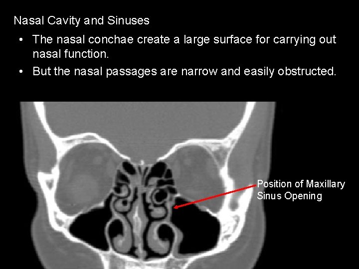 Nasal Cavity and Sinuses • The nasal conchae create a large surface for carrying