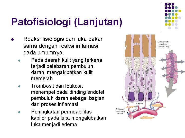 Patofisiologi (Lanjutan) Reaksi fisiologis dari luka bakar sama dengan reaksi inflamasi pada umumnya. l
