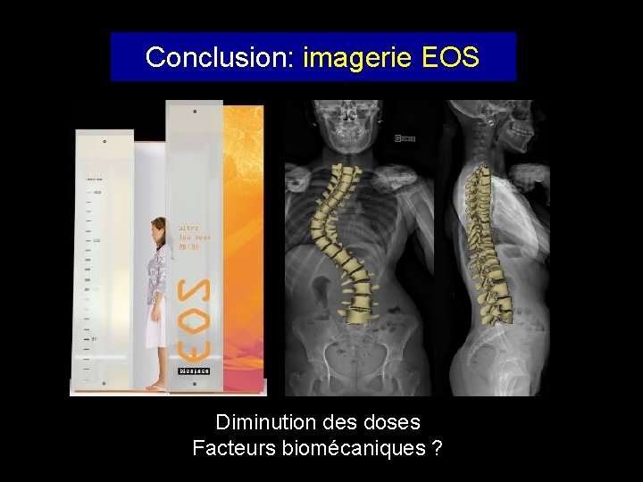 Conclusion: imagerie EOS Diminution des doses Facteurs biomécaniques ? 