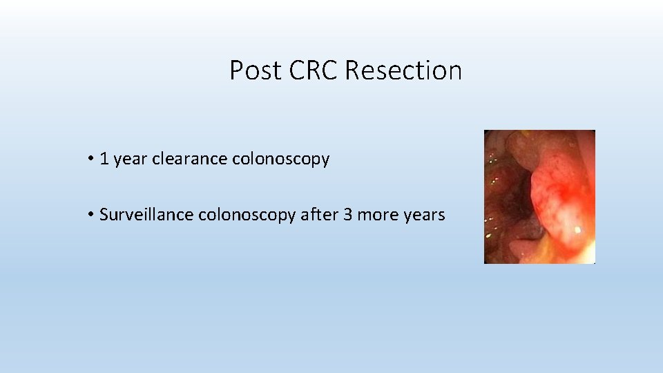 Post CRC Resection • 1 year clearance colonoscopy • Surveillance colonoscopy after 3 more