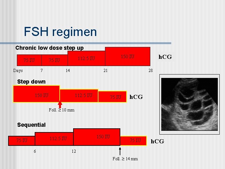FSH regimen Chronic low dose step up 75 IU Days 7 14 h. CG