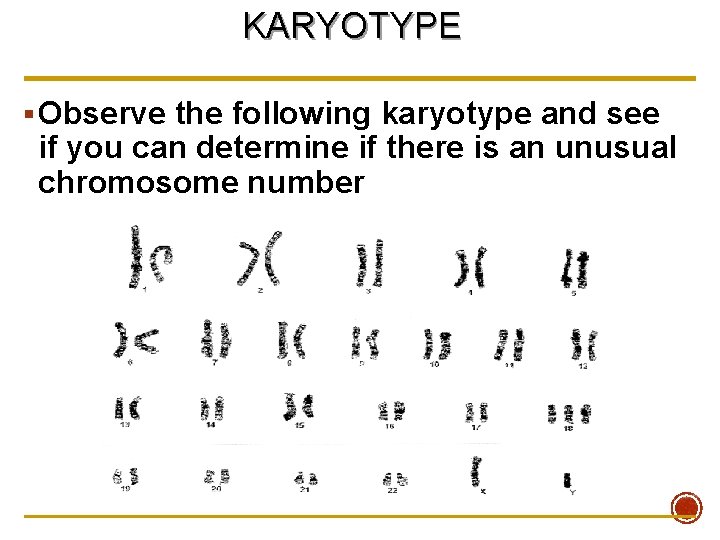 KARYOTYPE § Observe the following karyotype and see if you can determine if there