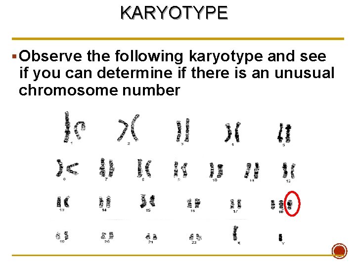 KARYOTYPE § Observe the following karyotype and see if you can determine if there