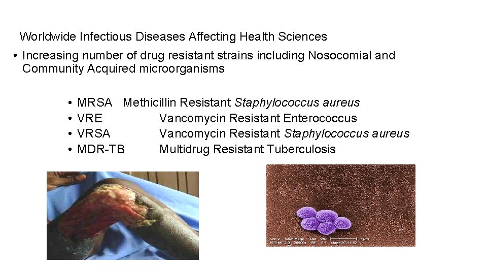 Worldwide Infectious Diseases Affecting Health Sciences • Increasing number of drug resistant strains including