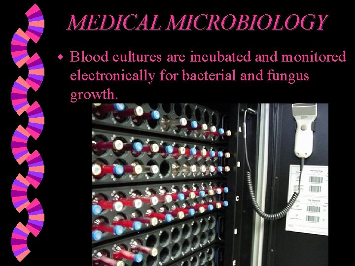 MEDICAL MICROBIOLOGY w Blood cultures are incubated and monitored electronically for bacterial and fungus