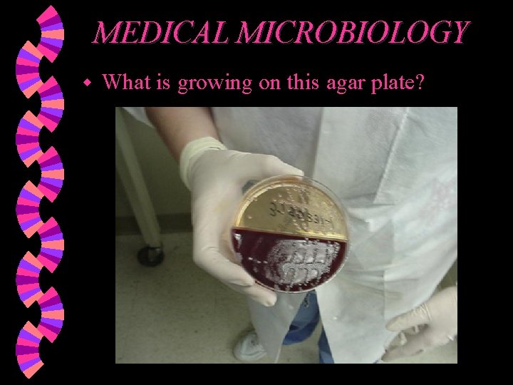 MEDICAL MICROBIOLOGY w What is growing on this agar plate? 