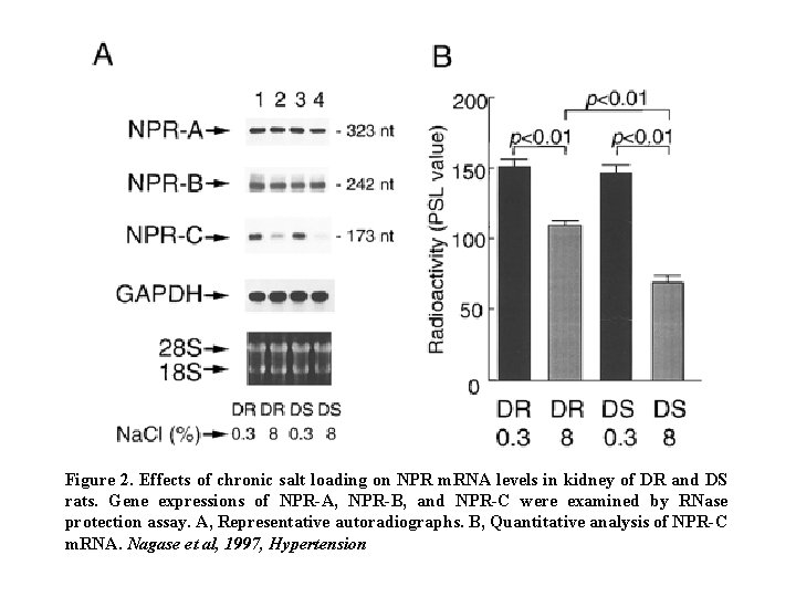 Figure 2. Effects of chronic salt loading on NPR m. RNA levels in kidney