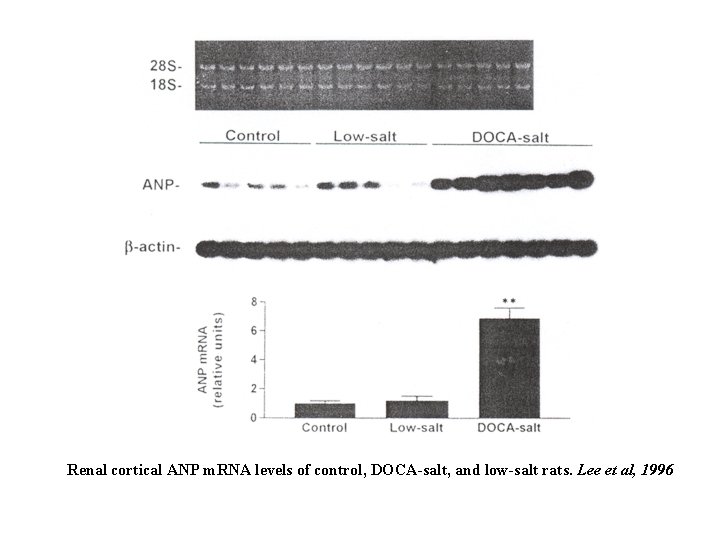 Renal cortical ANP m. RNA levels of control, DOCA-salt, and low-salt rats. Lee et